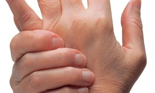 Cẩn thận với thói quen bẻ khớp