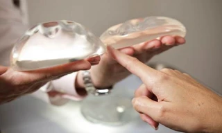  Chọn túi ngực phù hợp để vừa đẹp vừa an toàn