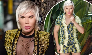 Thẩm mỹ 72 lần, anh chàng 'búp bê Ken' mặt ngày càng đơ không cảm xúc