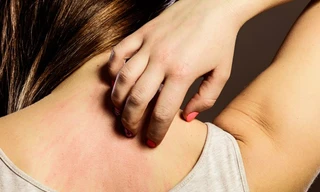 Ngứa hoài không dứt: Cảnh giác với 7 bệnh 'chết người'