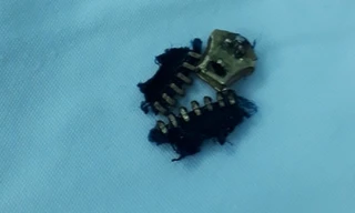 Ông bố nhập viện với 'cậu nhỏ' bị kẹt vào khóa quần