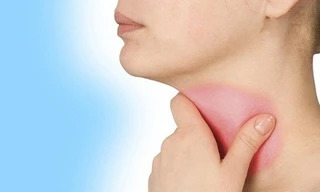 Phân biệt dấu hiệu ung thư phổi và viêm họng