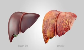 Ảnh minh họa: Bel Marra Health 