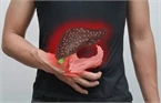 7 dấu hiệu cảnh báo gan bị nhiễm độc