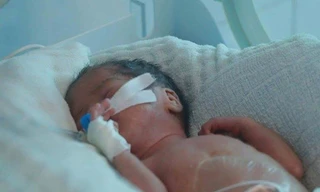 Bé 2 tháng tuổi tử vong sau khi cha mẹ tự chữa ho tại nhà