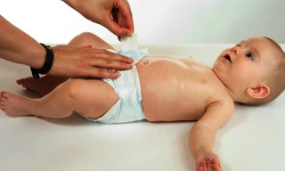 Thắc mắc hay gặp khi chăm trẻ tiêu chảy