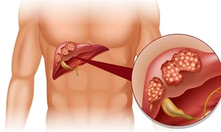 Ảnh minh họa tử Internet