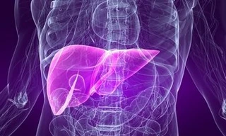 Những dấu hiệu sớm của bệnh ung thư gan