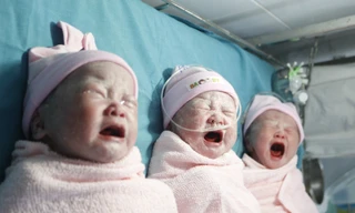 Sản phụ sinh ba bé gái đều cân nặng trên 2,5 kg
