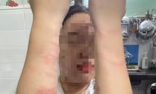 Điều tra vụ việc thiếu nữ 17 tuổi bị mẹ ruột đánh gây thương tích ở TP Thủ Đức 