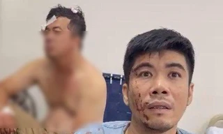 Bắt khẩn cấp 8 đối tượng liên quan vụ án mạng từ mâu thuẫn trẻ con 