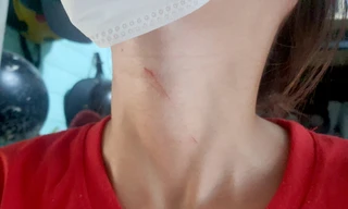 Kề dao vào cổ nữ nhân viên cướp bông tai trong nhà kho ở TPHCM