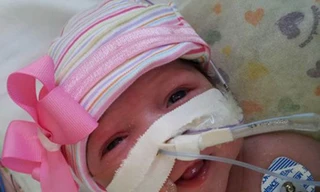 Bé gái có trái tim ngoài lồng ngực