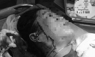 Hẹn đánh ghen, người đàn bà bị đâm, rạch nát mặt