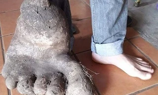 Lạ lùng củ khoai tây 8kg, y hệt bàn chân người khổng lồ