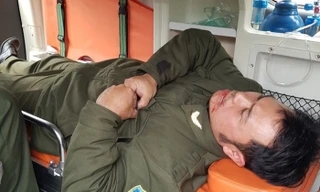 Trước đó, một nhân viên sân bay Nội Bài nhắc nhở các đối tượng "cò mồi" taxi hoạt động đã bị các đối tượng này hành hung gãy răng, rách môi 