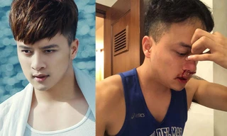 Cao Thái Sơn nhập viện khẩn cấp vì chảy máu mũi không ngừng
