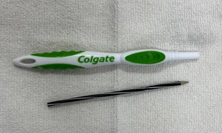 Phát hiện thân bàn chải đánh răng, ruột bút bi trong dạ dày nam thanh niên