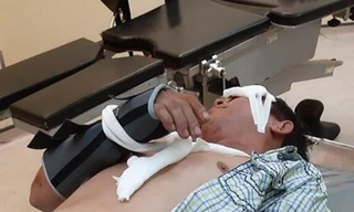 Say xỉn té xe, 2 'bợm nhậu' tung tin bị côn đồ chặn đánh vì sợ mẹ mắng