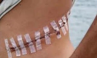 Thị trường đen buôn bán nội tạng người trên thế giới