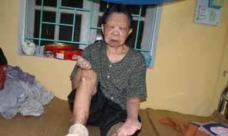 Cụ Vũ Thị Bớt đau khổ vì không thể tự sinh hoạt nay lại bị bỏ đói