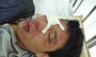 Nhân viên bán vé xe buýt bị hành hung dã man