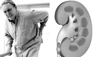 Bệnh thận ảnh hưởng đến chất lượng cuộc sống