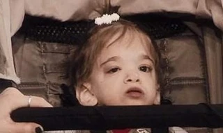 Thiếu nữ 20 tuổi 'kẹt' trong hình hài đứa trẻ sơ sinh