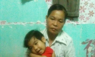 Cháu bé mắc bệnh chân voi cần được giúp đỡ