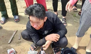 Học sinh bị đánh trên đường đi học về.