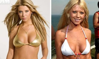 Siêu sao méo mặt vì phẫu thuật ngực