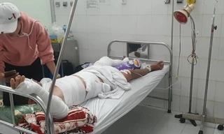 Ghe biển chuẩn bị ra khơi bất ngờ phát nổ làm ba người bị bỏng nặng