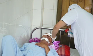 Cánh quạt máy bay không người lái chém gãy xương mũi người đi đường