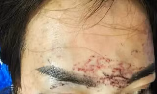 Vụ 'tố' bị bắt giữ, đánh đập, xăm mặt vì ghen: Khởi tố 2 người phụ nữ 