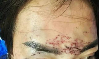 Vụ 'tố' bị bắt giữ, đánh đập, xăm mặt vì ghen: Khởi tố 2 người phụ nữ 