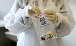 Biến thể SARS-CoV-2 của Nam Phi “còn đáng lo ngại hơn biến thể ở Anh”, lý do vì sao?