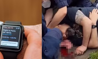 Đeo đồng hồ Apple Watch, chắc không ai nghĩ đến là có ngày nó sẽ cứu mạng mình