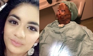 Đang ủ tóc bằng dầu gội đầu mà tóc bị bắt lửa, nữ sinh bị bỏng hết mặt và mất 7 ngón tay