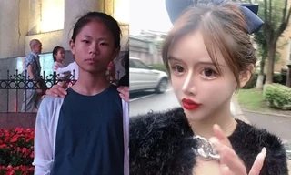 phẫu thuật thẩm mỹ