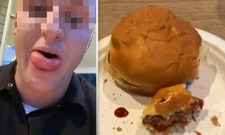 Thanh niên xui xẻo đang ăn bánh thì bị ong đốt vào lưỡi, sưng phồng không ngậm được miệng