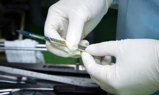 Em bé nuốt 2 viên nam châm