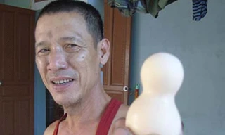 Kỳ lạ quả trứng gà hồ lô