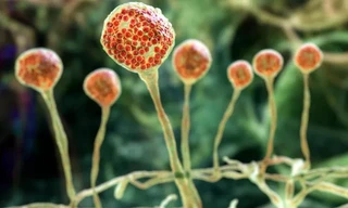 Cảnh báo về loại nấm đen cực độc, có thể gây chết người