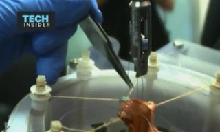 Robot phẫu thuật tự động giỏi hơn bác sĩ