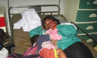 Lật xe công nông, 35 người nhập viện