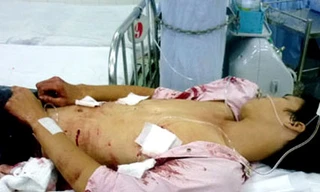 Nghi án chồng đâm chết vợ rồi tự sát