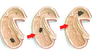 Robot mềm được thiết kế để đưa vào cơ thể người, thực hiện các nhiệm vụ y tế. Minh họa: Mashable.