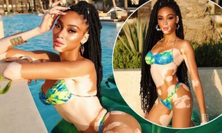 Winnie Harlow thả dáng chuẩn như tạc tượng