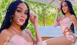 Winnie Harlow thư giãn bên hồ bơi với bikini nhỏ xíu