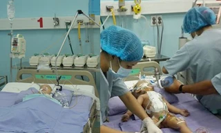 Những điều chưa biết trong ca mổ tách 2 bé dính liền